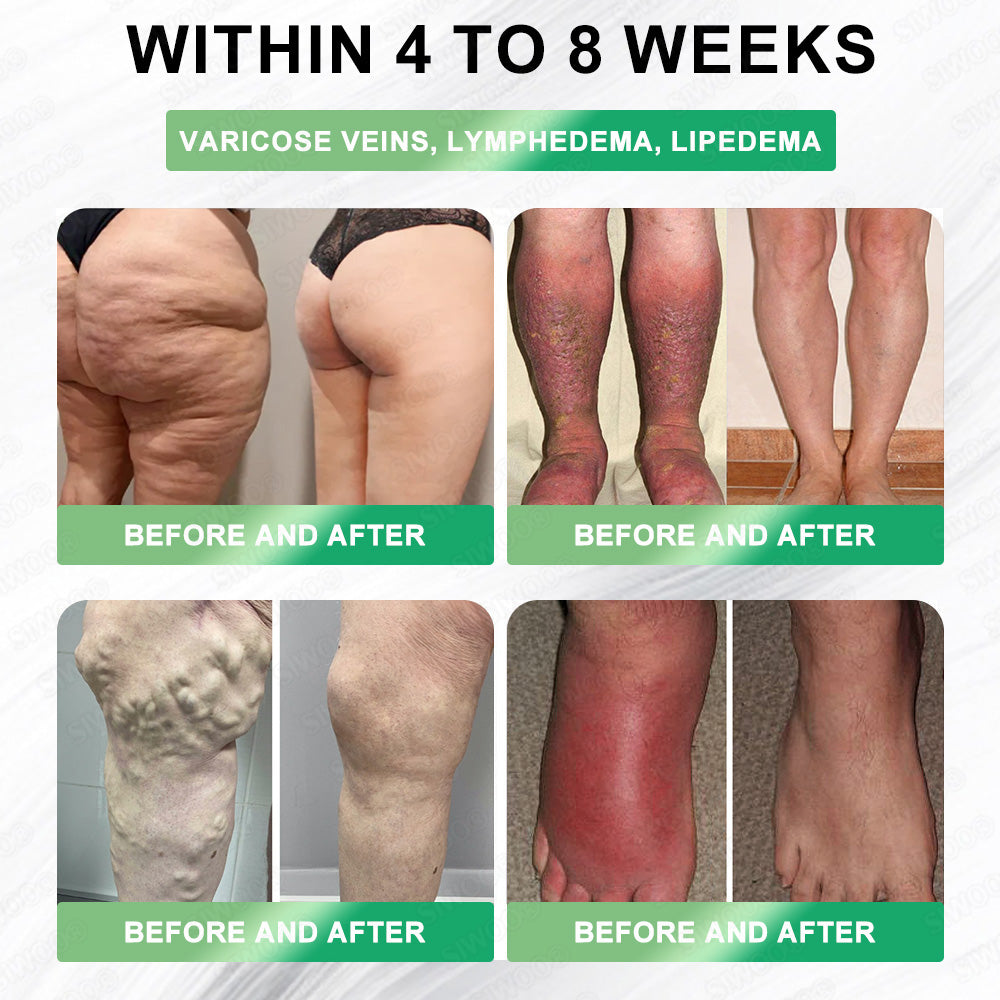 𝚂𝙸𝚆𝙾𝙾® 𝐺𝐿𝑃-1 6-𝑖𝑛-1 𝑴𝒆𝒕𝒂𝒃𝒐𝒍𝒊𝒄 𝑹𝒆𝒗𝒊𝒕𝒂𝒍𝒊𝒛𝒊𝒏𝒈 𝐎𝐫𝐚𝐥 𝐒𝐨𝐥𝐮𝐭𝐢𝐨𝐧 | 𝗦𝘂𝗽𝗽𝗼𝗿𝘁𝘀 𝗔𝗽𝗽𝗲𝘁𝗶𝘁𝗲 𝗖𝗼𝗻𝘁𝗿𝗼𝗹 · 𝗕𝗼𝗼𝘀𝘁𝘀 𝗠𝗲𝘁𝗮𝗯𝗼𝗹𝗶𝘀𝗺 · 𝗥𝗲𝗱𝘂𝗰𝗲𝘀 𝗕𝗹𝗼𝗮𝘁𝗶𝗻𝗴 & 𝗪𝗮𝘁𝗲𝗿 𝗥𝗲𝘁𝗲𝗻𝘁𝗶𝗼𝗻