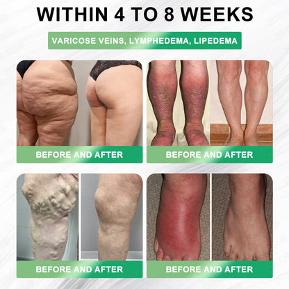 𝚂𝙸𝚆𝙾𝙾® 𝐺𝐿𝑃-1 6-𝑖𝑛-1 𝑴𝒆𝒕𝒂𝒃𝒐𝒍𝒊𝒄 𝑹𝒆𝒗𝒊𝒕𝒂𝒍𝒊𝒛𝒊𝒏𝒈 𝐎𝐫𝐚𝐥 𝐒𝐨𝐥𝐮𝐭𝐢𝐨𝐧 | 𝗦𝘂𝗽𝗽𝗼𝗿𝘁𝘀 𝗔𝗽𝗽𝗲𝘁𝗶𝘁𝗲 𝗖𝗼𝗻𝘁𝗿𝗼𝗹 · 𝗕𝗼𝗼𝘀𝘁𝘀 𝗠𝗲𝘁𝗮𝗯𝗼𝗹𝗶𝘀𝗺 · 𝗥𝗲𝗱𝘂𝗰𝗲𝘀 𝗕𝗹𝗼𝗮𝘁𝗶𝗻𝗴 & 𝗪𝗮𝘁𝗲𝗿 𝗥𝗲𝘁𝗲𝗻𝘁𝗶𝗼𝗻